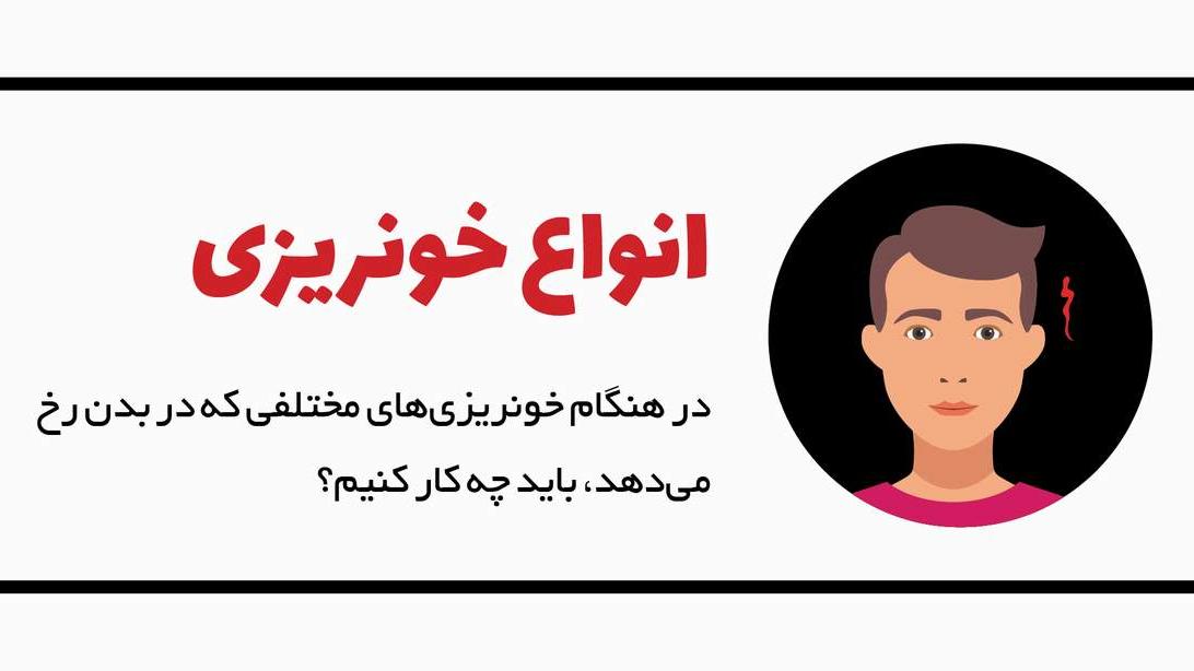 کمک‌های اولیه در هنگام خونریزی/ این 8 اینفوگرافیک را ببینید